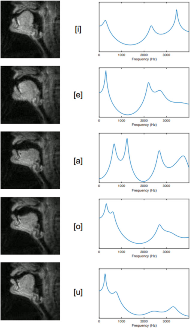 Correlates of Vocal Tract Evolution in Late Pliocene and Pleistocene Hominins.