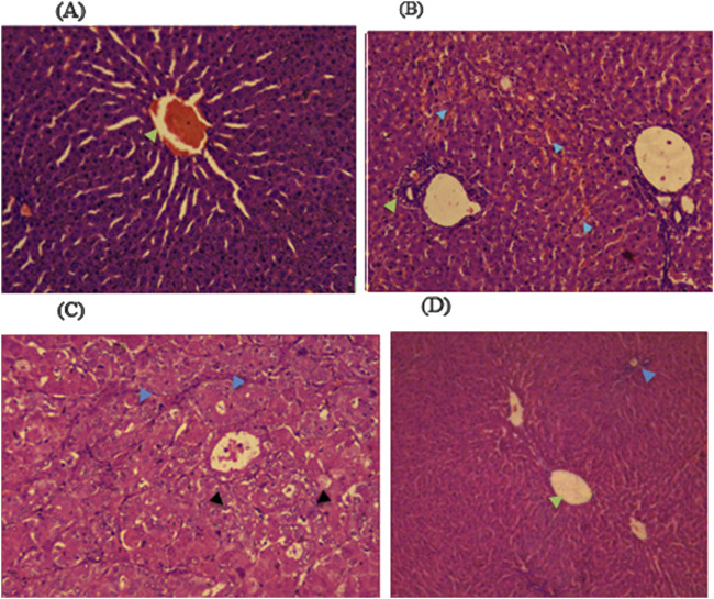 Toxic effects of <i>Lepidium sativum</i> seed fixed oil on Wistar albino rats in acute and subacute toxicity models.