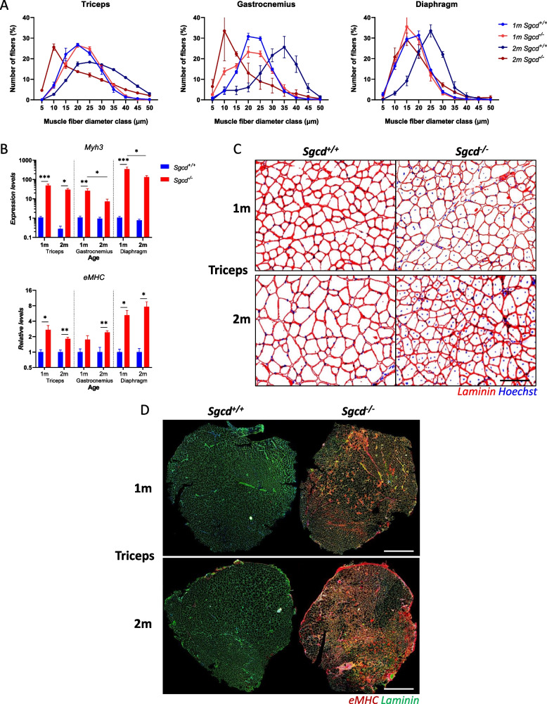 Dysregulated ATX-LPA and YAP/TAZ signaling in dystrophic Sgcd<sup>-/-</sup> mice with early fibrosis and inflammation.