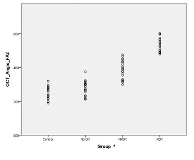 Serum pro-brain natriuretic peptide correlates with optical coherence tomography indices in diabetic retinopathy.