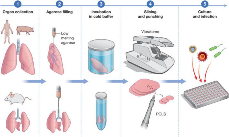 Novel Approach Methodologies in Modeling Complex Bioaerosol Exposure in Asthma and Allergic Rhinitis Under Climate Change.
