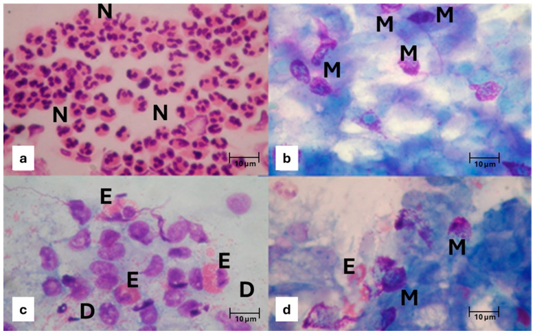 Rhinitis in the Geriatric Population: Epidemiological and Cytological Aspects.