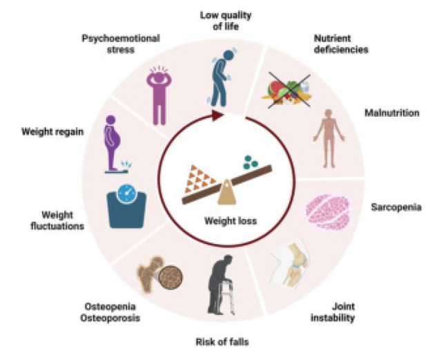 Weight Loss, but Not at Any Cost: Risks and Challenges in Patients with Osteoarthritis.