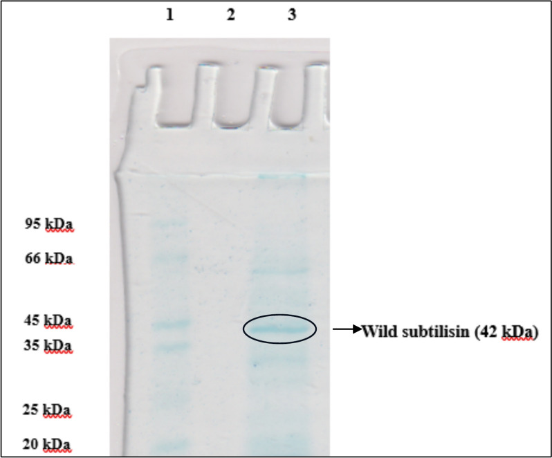 Comprehensive biochemical, molecular and structural characterization of subtilisin with fibrinolytic potential in bioprocessing.