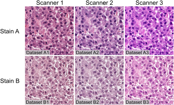 Artificial intelligence can be trained to predict <i>c-KIT</i>-11 mutational status of canine mast cell tumors from hematoxylin and eosin-stained histological slides.