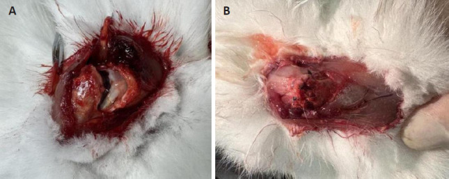Hyperbaric oxygen treatment promotes tendon-bone interface healing in a rabbit model of rotator cuff tears.