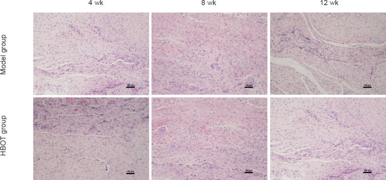 Hyperbaric oxygen treatment promotes tendon-bone interface healing in a rabbit model of rotator cuff tears.