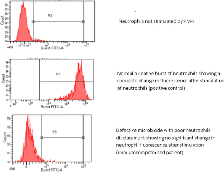 Clinical manifestations of 42 Moroccan patients with chronic granulomatous disease.