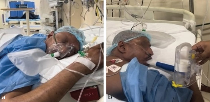Challenging Perioperative Management of a MEN2A Syndrome Patient Complicated by Eisenmenger Syndrome.