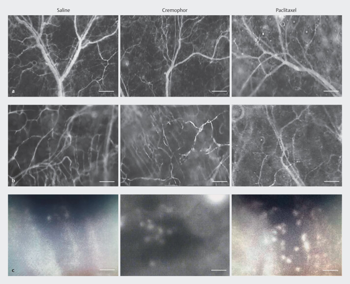 The Role of Microcirculatory Dysfunction During Paclitaxel Treatment as a Critical Co-Factor for the Development of Chemotherapy-Induced Peripheral Neuropathy.