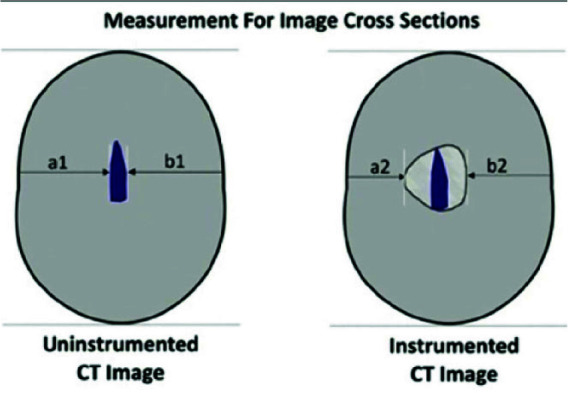Comparison of Hand Files, Mtwo, Reciproc, and Gentlefile Rotary Systems Regarding Canal Transportation, Centering Ability, and Obturation Quality of Primary Molars.