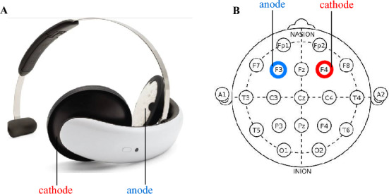 Effect of home-based transcranial direct current stimulation (tDCS) on cognitive functioning in bipolar depression: an open-label, single-arm acceptability and feasibility study.