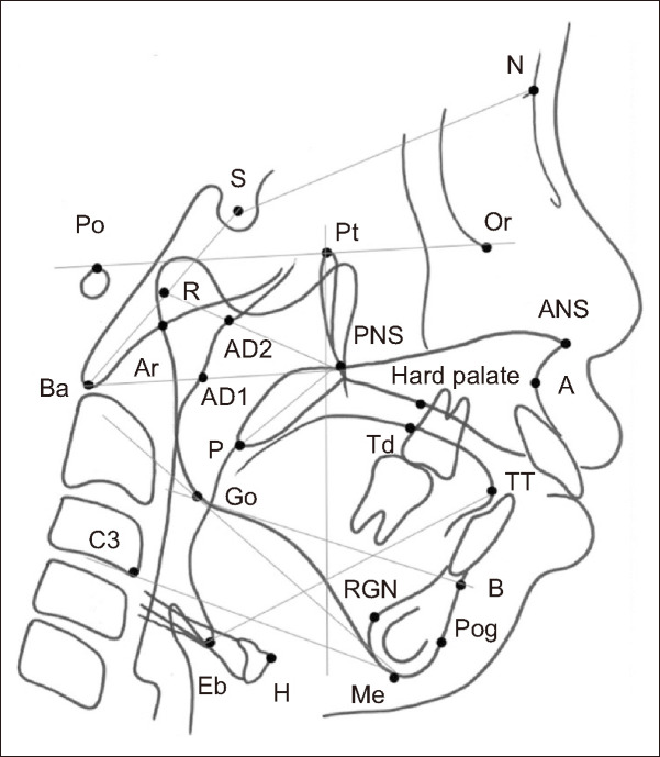 Preliminary study on change in the upper airway dimension in growing patients with Pierre-Robin sequence.