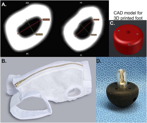 Development of a small animal bone-anchored limb replacement model for infection interventions.