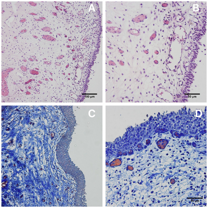 Bladder Mucosa Harvested with Holmium Laser for Treatment of Urethral Strictures: Does the Graft Have its Tissue Integrity Preserved?