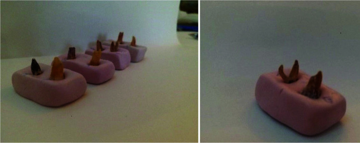 Comparison of Hand Files, Mtwo, Reciproc, and Gentlefile Rotary Systems Regarding Canal Transportation, Centering Ability, and Obturation Quality of Primary Molars.