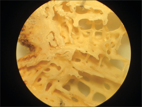 Comparative evaluation of characteristics of spongiosa in alveolar and basal bones of human jaws: A dry skull study.