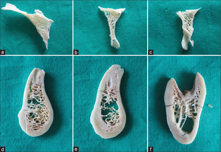 Comparative evaluation of characteristics of spongiosa in alveolar and basal bones of human jaws: A dry skull study.