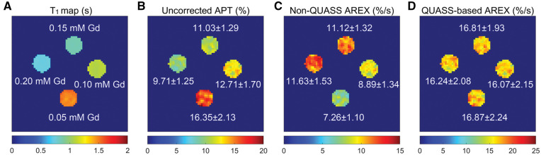 Mitigation of T<sub>1</sub> impact for unbiased tumor magnetic resonance amide proton transfer imaging at 3T.