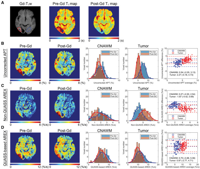 Mitigation of T<sub>1</sub> impact for unbiased tumor magnetic resonance amide proton transfer imaging at 3T.