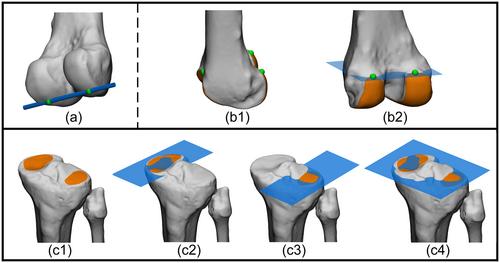 A structured framework for standardized 3D leg alignment analysis: An international Delphi consensus study