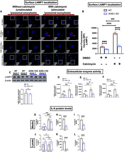 The Alzheimer's Disease Gene SORL1 Regulates Lysosome Function in Human Microglia