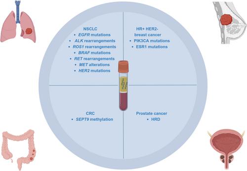 Liquid Biopsy in Solid Tumours: An Overview