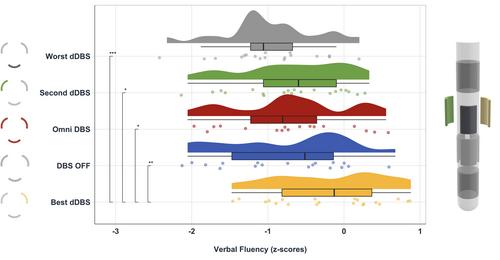 Antero-Lateral Subthalamic Nucleus Theta Stimulation Improves Verbal Fluency in Parkinson's Disease