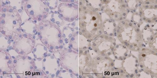 Induction of proximal tubular proliferation and lengthening in response to sodium glucose linked cotransporter-2 inhibition in experimental rats
