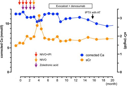 A Case of Advanced Renal Cell Carcinoma With Concomitant Development of Multiple Endocrine Neoplasia Type 1 That Affected Treatment Progress With Immunotherapy