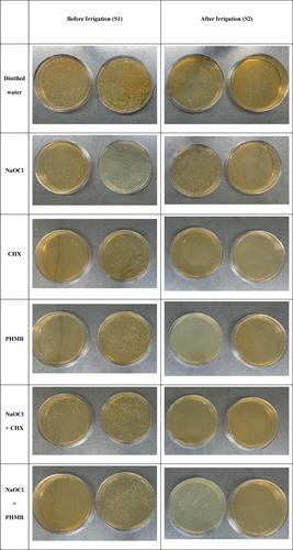 The Effect of Various Irrigants on Mixed Biofilms in Dentinal Tubules: A Confocal Laser Scanning Microscopy Study