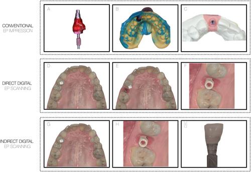 Accuracy of Digital Impression Methods for Capturing the Peri-Implant Emergence Profile: A Systematic Review