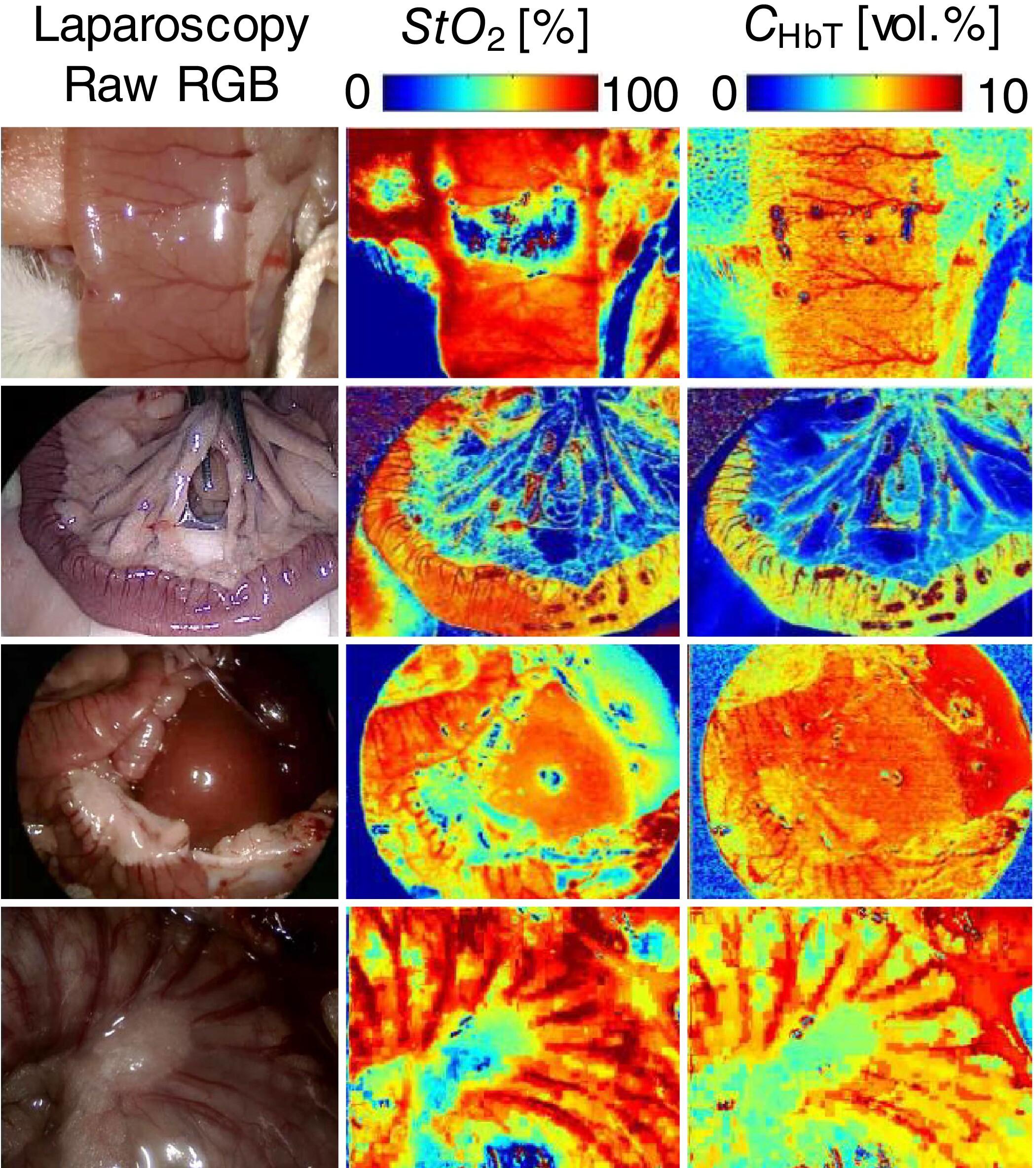 RGB-Image-Based Real-Time Hemodynamic Monitoring of Intraperitoneal Organs in Rats Using a Standard Laparoscopic Imaging System