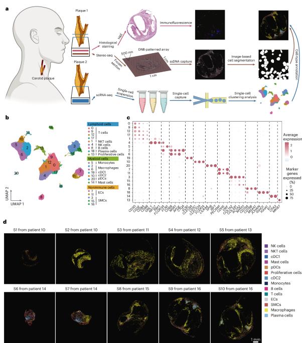 Single-cell spatial transcriptomics of tertiary lymphoid organ-like structures in human atherosclerotic plaques