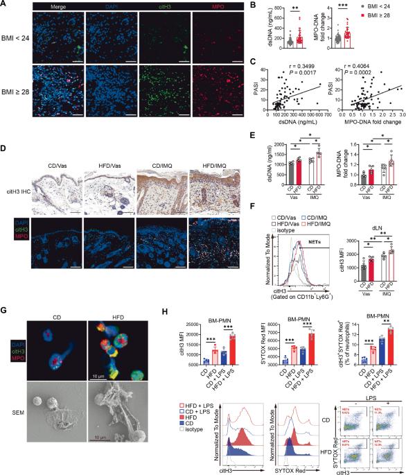 Saturated fatty acid-induced neutrophil extracellular traps contribute to exacerbation and biologic therapy resistance in obesity-related psoriasis