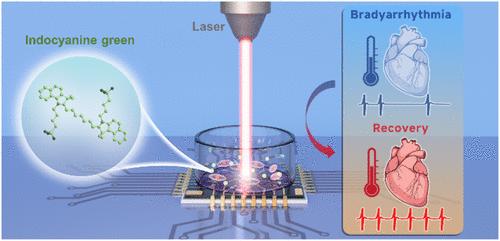 High-Efficiency ICG Molecular Vibration Therapy for Bradyarrhythmia Using Cardiomyocyte-Based Biosensing