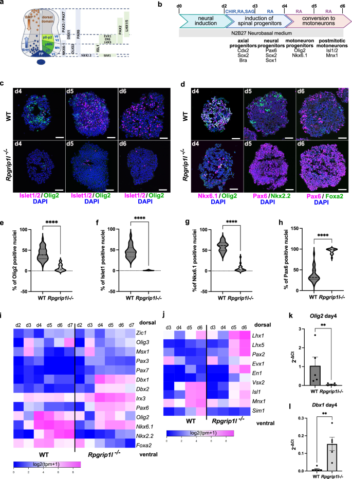 A differential requirement for ciliary transition zone proteins in human and mouse neural progenitor fate specification