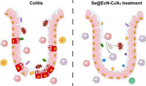 Triple-Functional Probiotics with Intracellularly Synthesized Selenium Nanoparticles for Colitis Therapy by Regulating the Macrophage Phenotype and Modulating Gut Microbiota
