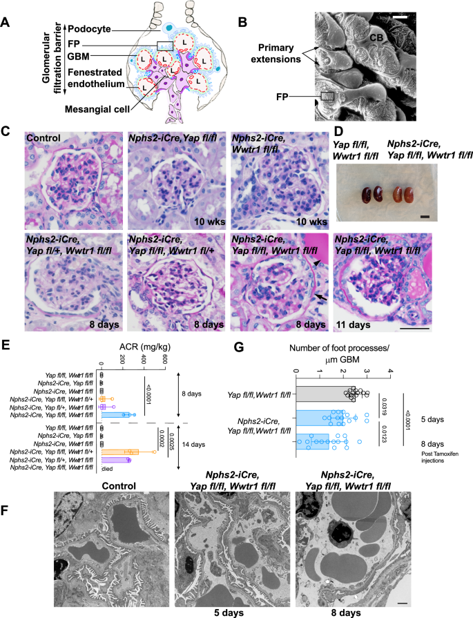 The integrin repertoire drives YAP-dependent epithelial:stromal interactions during injury of the kidney glomerulus