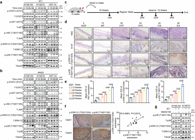 p38 mediated ACSL4 phosphorylation drives stress-induced esophageal squamous cell carcinoma growth through Src myristoylation