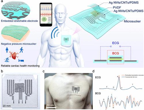 Electrically Stable and Reliably Adhered E-Skin for Heart Health Monitoring