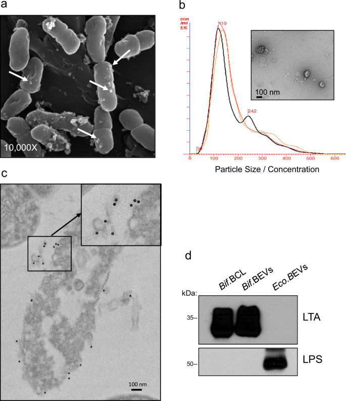 Gut commensal Bifidobacterium-derived extracellular vesicles modulate the therapeutic effects of anti-PD-1 in lung cancer
