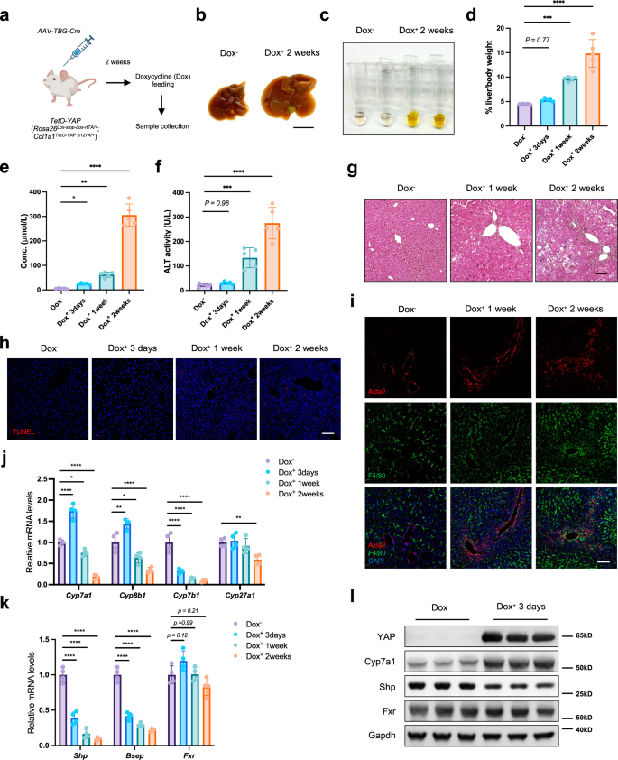 Disrupting bile acid metabolism by suppressing Fxr causes hepatocellular carcinoma induced by YAP activation