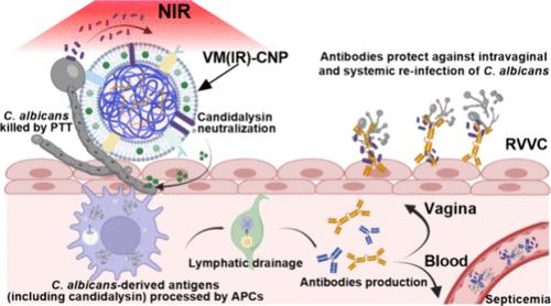 Treating and Protecting against Recurrent Vulvovaginal Candidiasis Using the Vaginal Epithelial Cell Membrane-Based Photoimmunotherapeutic Nanoplatform