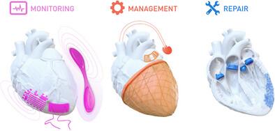 Materials Advances in Devices for Heart Disease Interventions