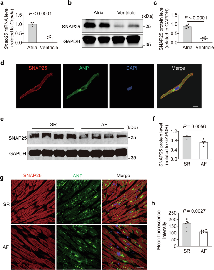 SNAP25-dependent membrane trafficking of the Kv1.5 channel regulates the onset of atrial fibrillation