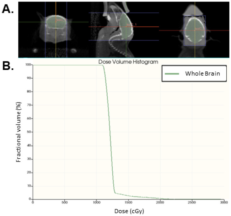 Combined MR Volumetry and T2* Relaxometry Reveals the Olfactory System as an Iron-Dependent Structure Affected by Radiation.