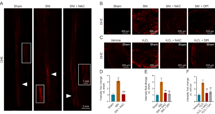 Corrigendum to "Hydralazine represses Fpn ubiquitination to rescue injured neurons via competitive binding to UBA52" [J. Pharm. Anal. 14 (2024) 86-99].