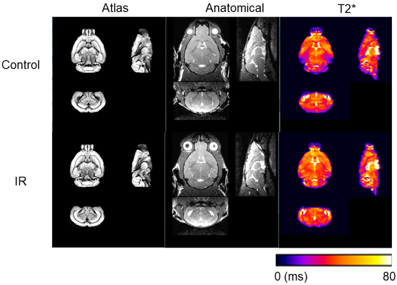 Combined MR Volumetry and T2* Relaxometry Reveals the Olfactory System as an Iron-Dependent Structure Affected by Radiation.