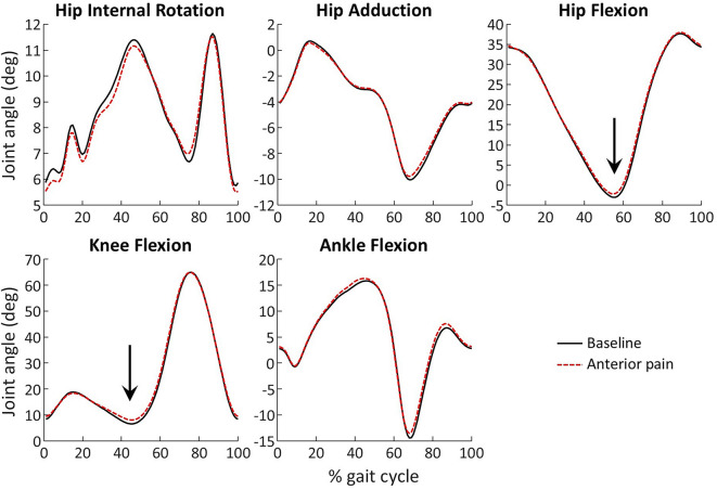 Effect of experimental knee pain location on gait kinematics.